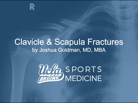 Clavicle & Scapula Fractures
