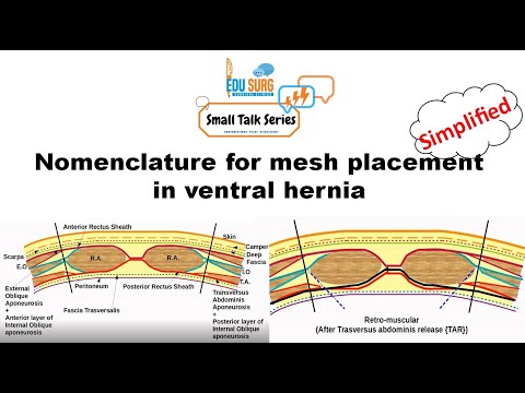Ventral hernia surgery - Planes for mesh placement - Terminology demystified