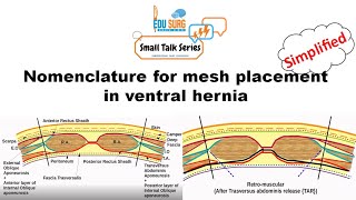 Ventral hernia surgery - Planes for mesh placement - Terminology demystified