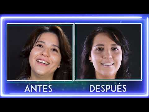 CARILLAS Y DSD | ANTES Y DESPUES