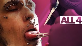 Splitting Your Tongue With A Scalpel | Body Mods