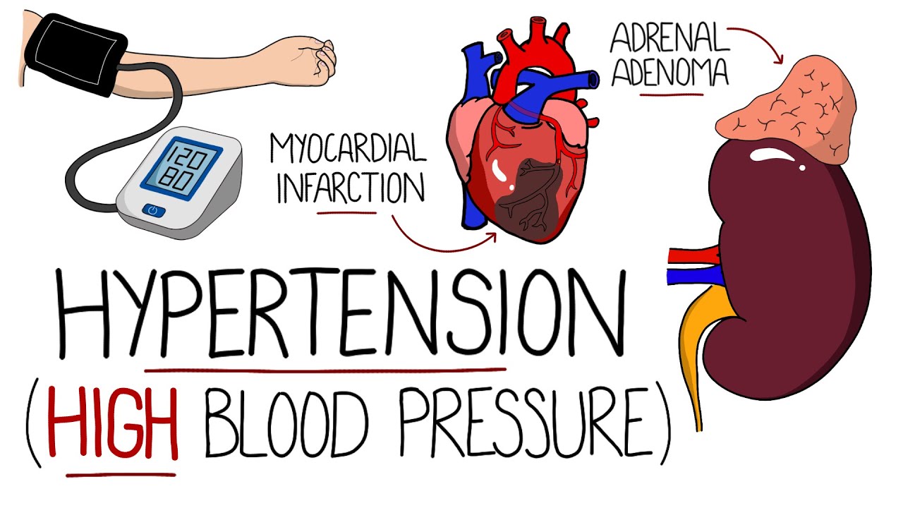 Hypertension Explained (High Blood Pressure) - Includes Hypertensive Emergency & NICE Guidelines