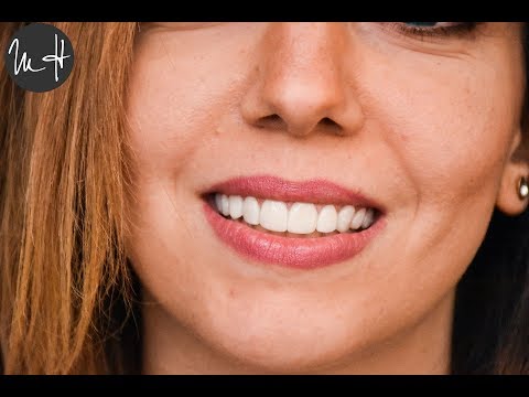 افضل دكتور أسنان فى مصر - دكتور محمود حسن -