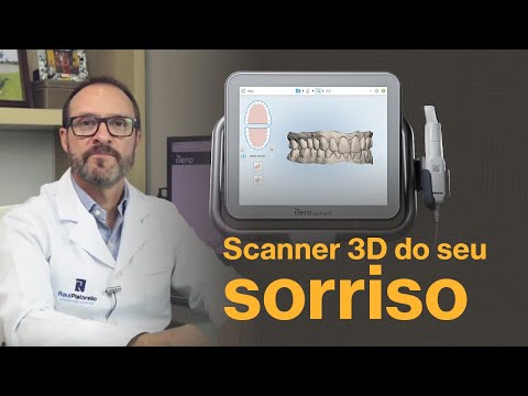 Invisalign e o Scanner Intra Oral iTero - Clínica Raul Pistorello Ortodontia Blumenau