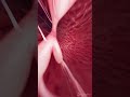 3d Animation Of The Tricuspid Valve Meded Anatomy 3dmodel