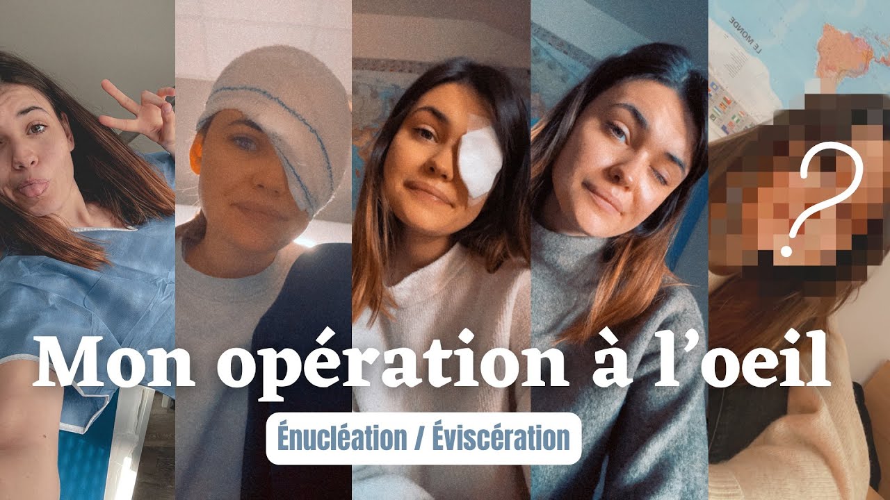 Mon opération à l'oeil : le début d'une nouvelle vie
