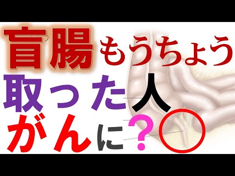 医師が脳腫瘍を虫垂炎と間違え男性死亡