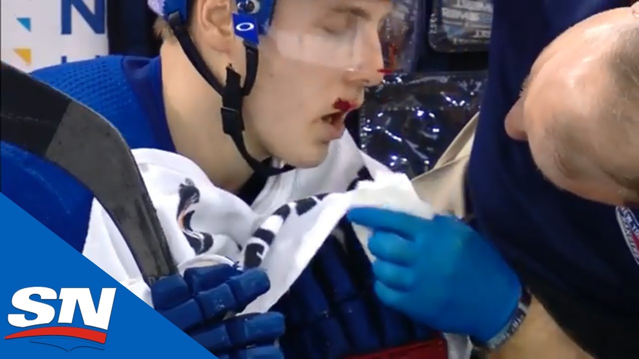 OUCH....Tu tombes la FACE PREMIÈRE.... Sur la glace..