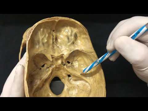Skull Osteology - Cranial Cavity Anatomy