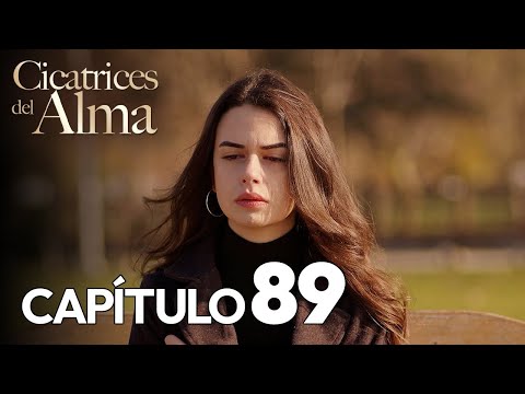Cicatrices Del Alma Capítulo 89 | Alaca Doblaje Español