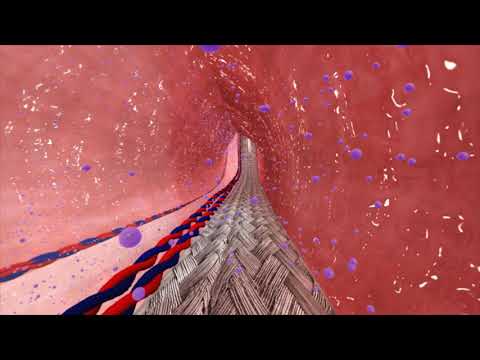 Synergo® for Bladder Cancer - Wondering how it works?