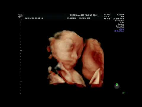 15-8\nguyễn phương thảo 25.01.1995