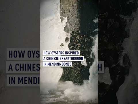 How oysters inspired a Chinese breakthrough in mending bones