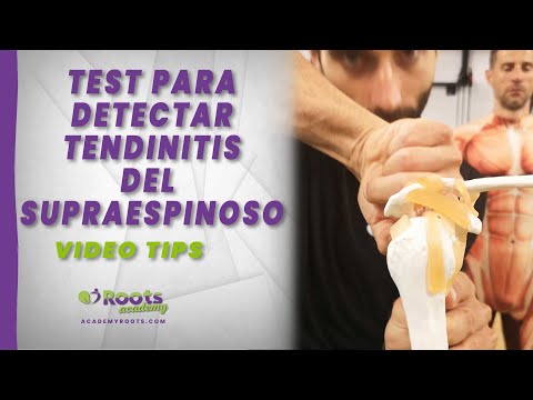 🎥 Test to detect supraspinatus tendonitis - Roots video tips ✅⁣