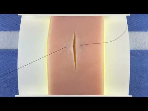 Horizontal Mattress Suture