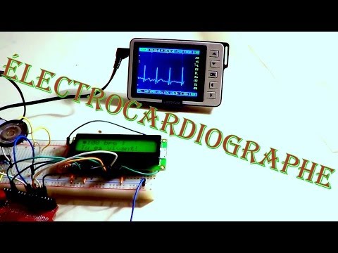 comment poser electrodes pour ecg