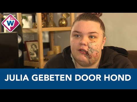 Julia moet jaar revalideren na pitbullaanval - Omroep West