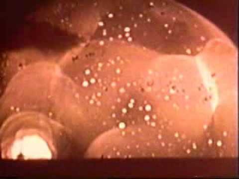 гоР° Ð »ÐμÑ Ñ ‡ ÐμниÐμ Ð¿Ð¸Ð½Ñ < Schmerzen in der linken Seite der Rückseite unterhalb der Rippen