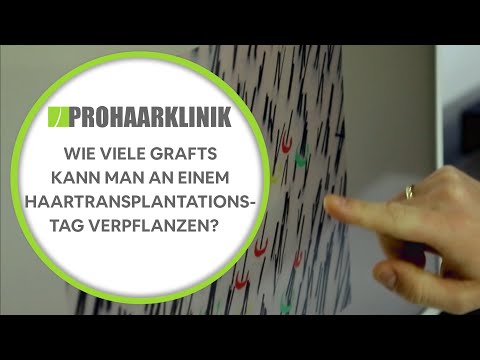 Wie viele Grafts kann man an einem Haartransplantationstag verpflanzen? - PROHAARKLINIK