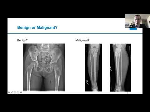 Image - Orthopedic Oncology: Benign or Malignant X-ray