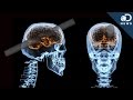 What Could Happen After A Brain Injury?
