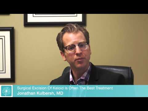 Surgical Removal of a Keloid | Charlotte Facial Plastic Surgeon