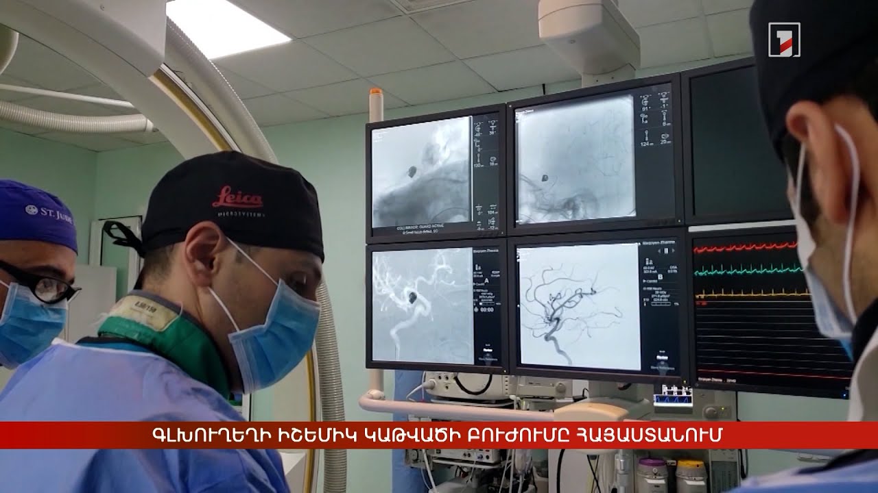 Գլխուղեղի իշեմիկ կաթվածի բուժումը Հայաստանում