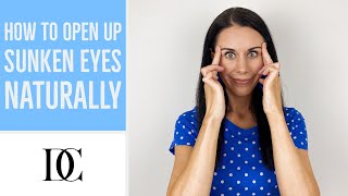 How To Open Up Sunken Eyes Naturally