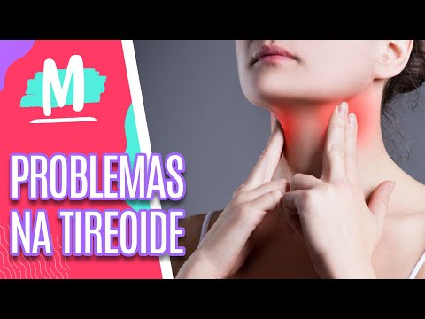Tire dúvidas sobre a tireoide e conheça a história da Regiane Tapias - Mulheres (03/03/22)