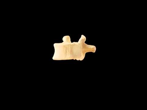 Come utilizzare ALMAG con il video osteocondrosi cervicale Qual è osteocondrosi come le Medico cura