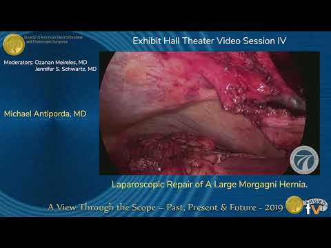 Traitement d'une volumineuse hernie diaphragmatique de Morgagni par laparoscopie