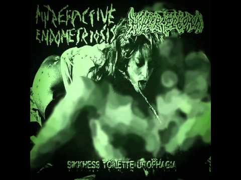 Hysteraectomia - Swimming In Hot Tub With The Feces (3 tracks)