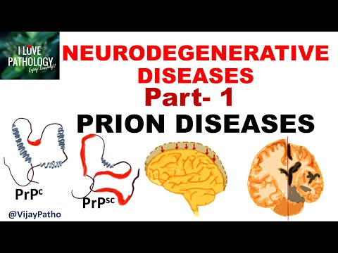 NEURODEGENERATIVE DISEASES PART 1: PRION DISEASES