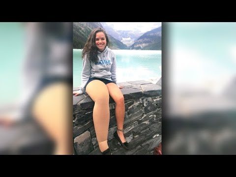 Body-Positive Teen With Rare Condition Challenges Beauty Standards