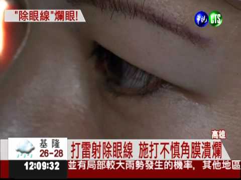 打雷射除眼線 角膜潰爛險失明