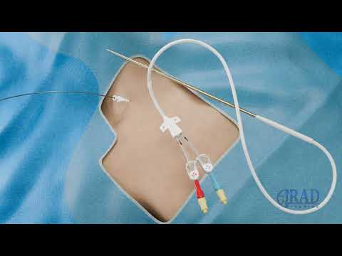 Tunneled Dialysis Catheter Placement