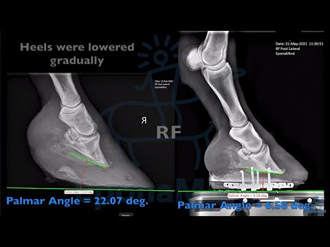 Laminitic Case - (3 month case study)
