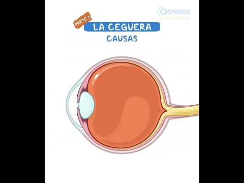 Diagnostics on Demand Cardiac tamponade