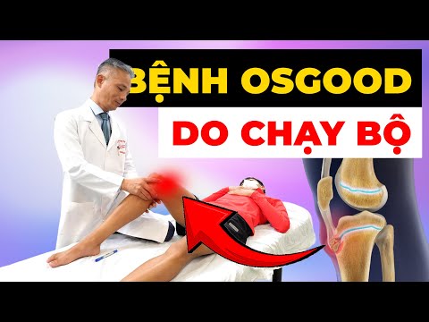Bệnh Osgood Do Chạy Bộ – Đau Dưới Gối Âm Ỉ, Đừng Nghĩ Chỉ Là Mỏi Chân