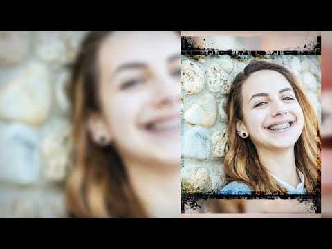 Dental Services offered