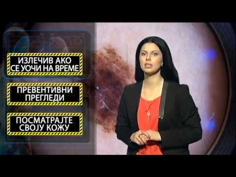 Tako stoje stvari - Nazdravlje - Melanom - 03.11.2017.