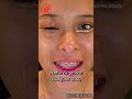 Testimonio Fatima - Gotas de primera extracción de miel de Melipona para ojos Beecheii