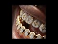 FREE Melodic Type Beat DRIP Type Beat Freestyle Beat Free Trap Rap Instrumental 2025