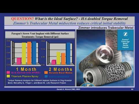 Does HA coating increase attachment strength and does trabecular metal reduce initial stability?