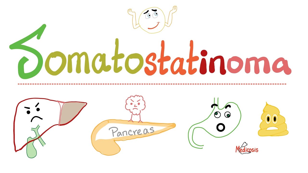 Somatostatinoma - Pancreatic Neuroendocrine Tumors - Islet Cell Tumors - Biochemistry & Pathology