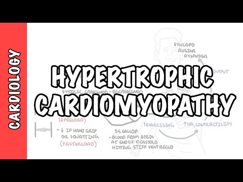 Miocardiopatía hipertrófica - signos y síntomas, causas, fisiopatología, tratamiento