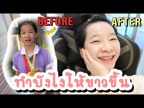 ฉีดผิวขาว