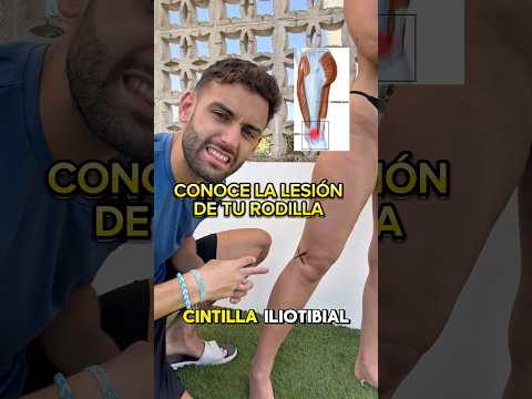 What's your knee pain called? Here are the most common injuries to the outside of the knee.