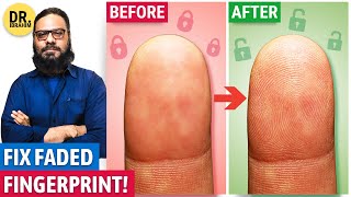 Recover Your Fingerprint! Improve Fingerprint Quality | Urdu/Hindi | Dr. Ibrahim