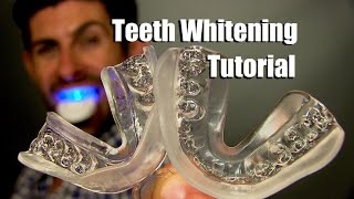 Home Teeth Whitening Tutorial | How To Whiten Your Teeth At Home For Best Results